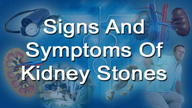 Kidney Stone Signs – You Should Not Ignore! – Virily